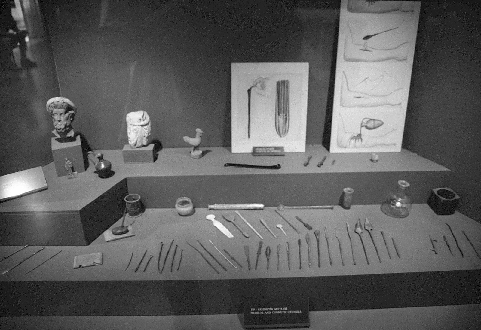 Instruments médicaux de l’époque romaine conservés à Éphèse.